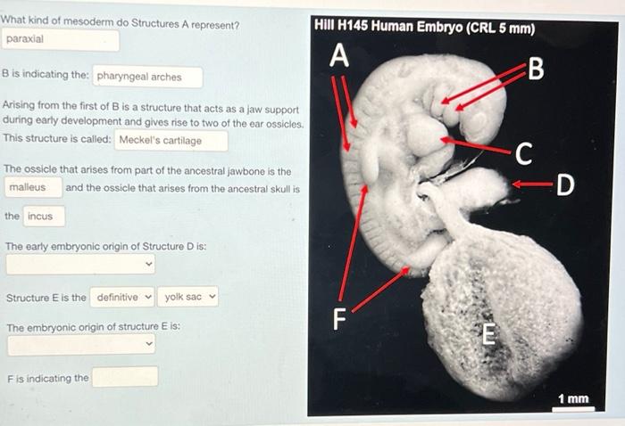Solved What kind of mesoderm do Structures A represent? | Chegg.com