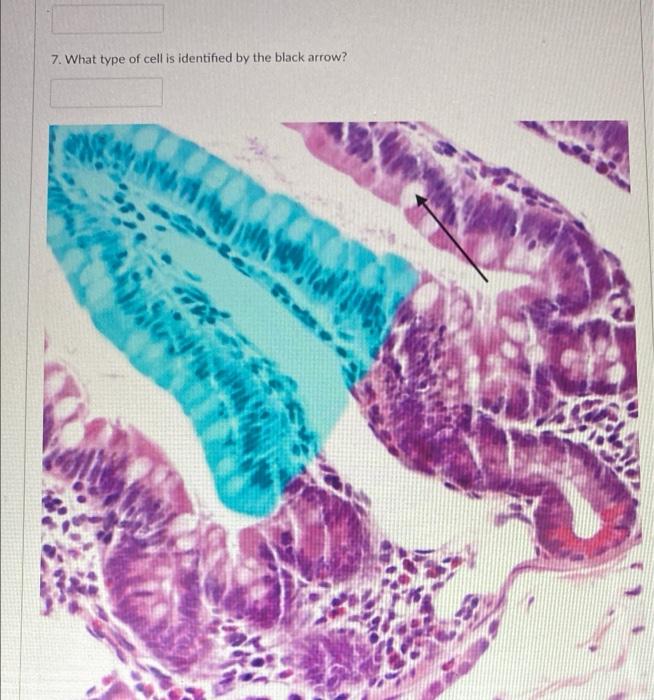 Solved 7. What type of cell is identified by the black | Chegg.com