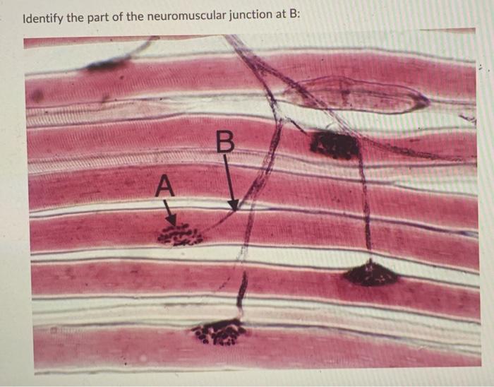 Solved Identify the part of the neuromuscular junction at B: | Chegg.com
