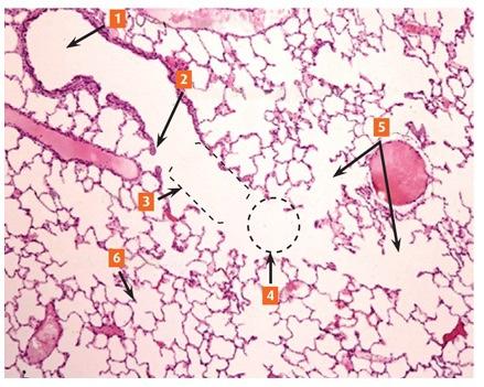 Solved identify the terminal branches of the bronchial tree | Chegg.com