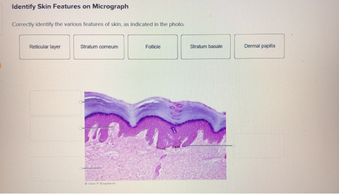 Solved Identify Skin Features on Micrograph Correctly | Chegg.com