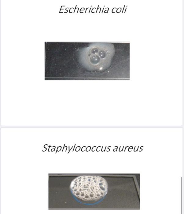 Solved Activity (1) Starch Hydrolysis Staphylococcus aureus