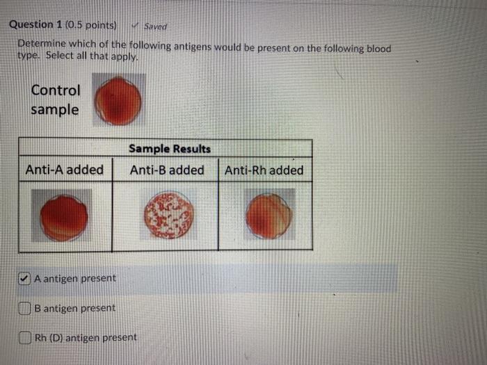 Solved determine which of the following antigens would be
