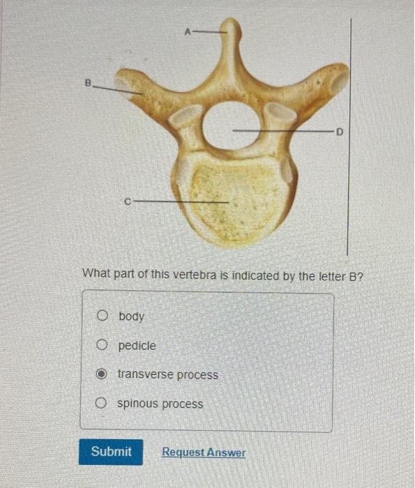 Solved What Part Of This Vertebra Is Indicated By The Letter | Chegg.com