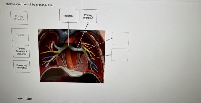 Label the structures of the bronchial tree.