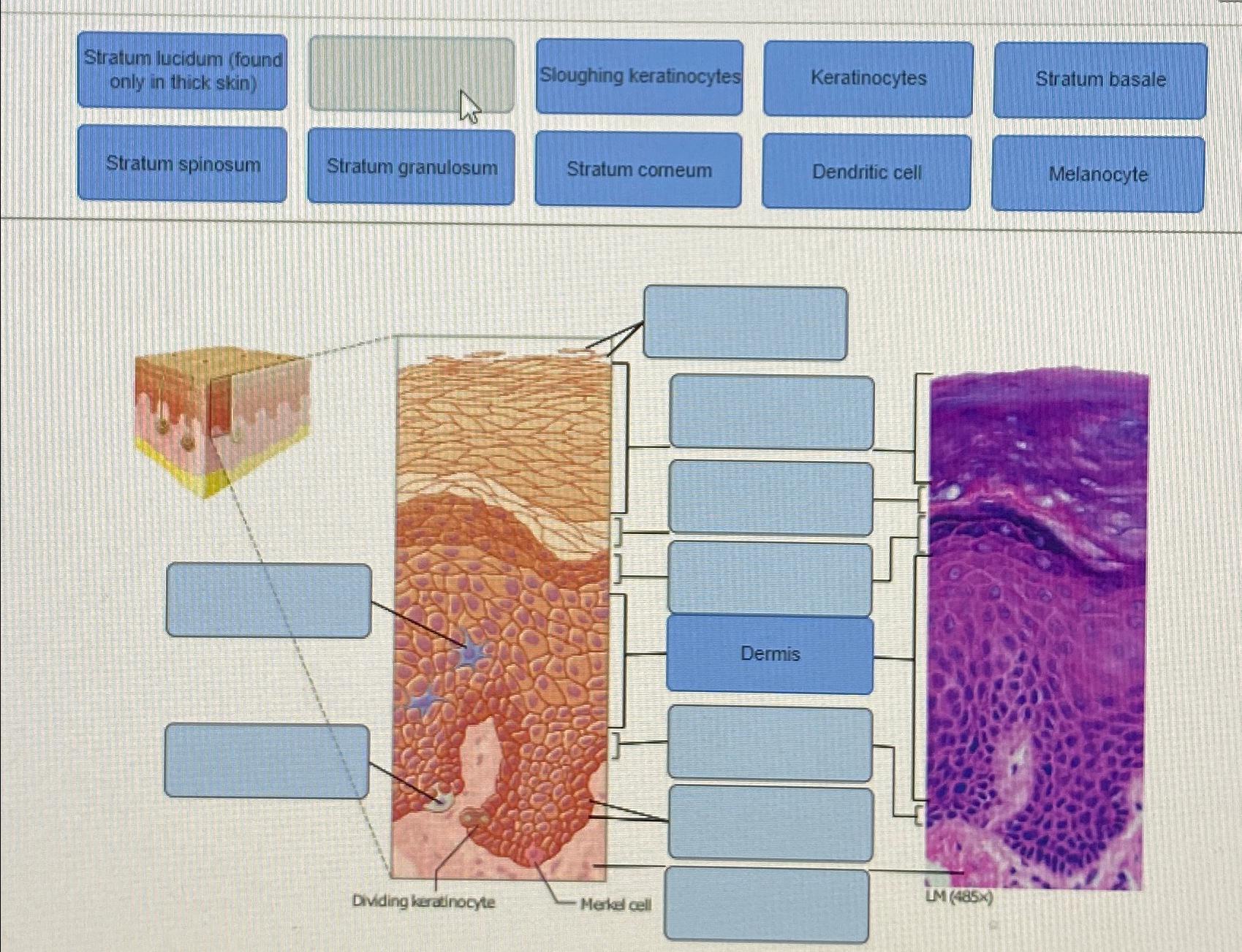 Solved Stratum lucidum (found only in thick skin)Stratum | Chegg.com