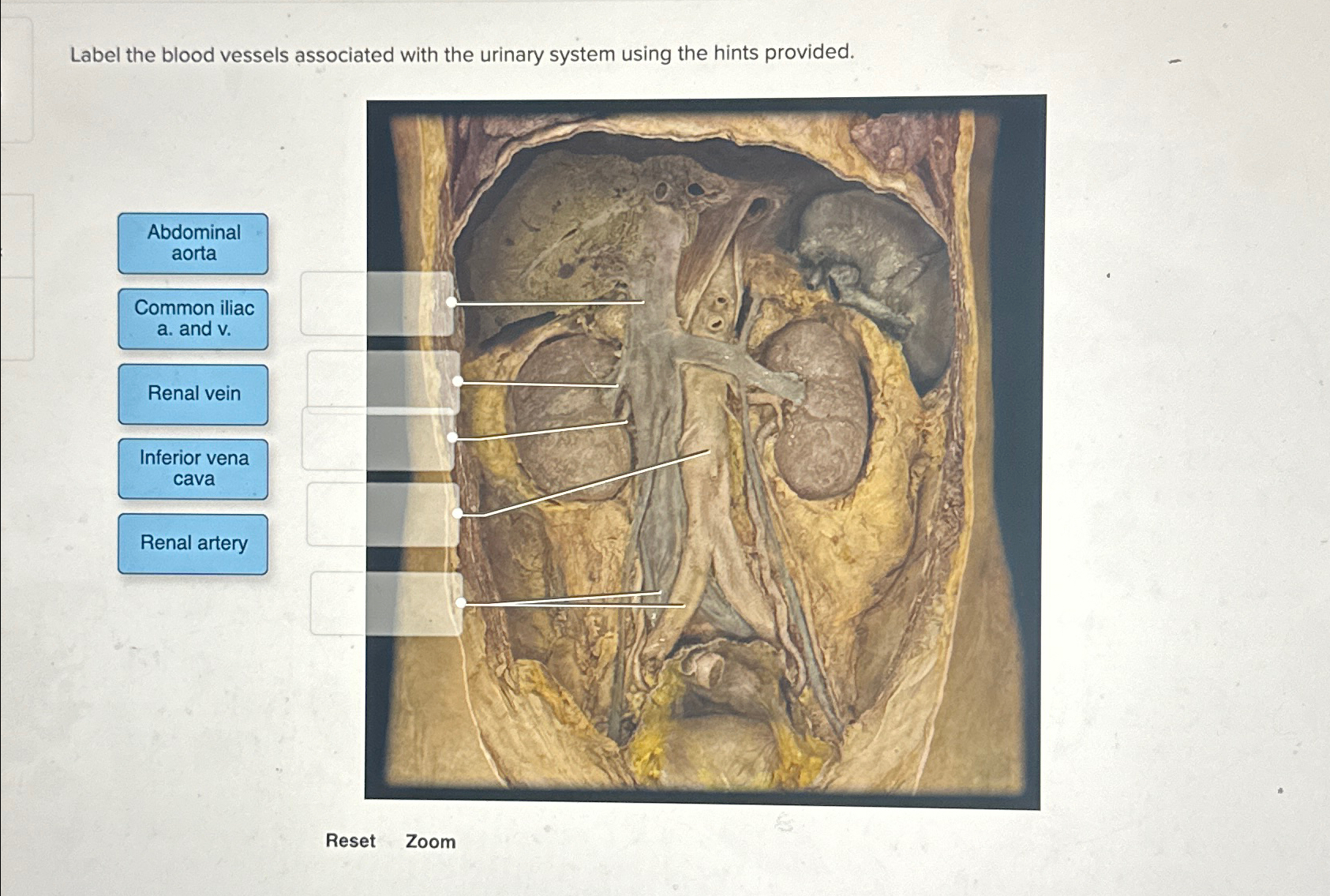 Solved Label the blood vessels associated with the urinary | Chegg.com