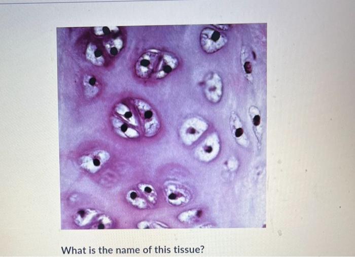 What is the name of this tissue? What is the name | Chegg.com