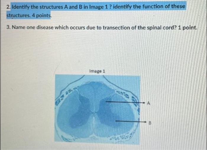 Solved 2. Identify The Structures A And B In Image 1 ? | Chegg.com