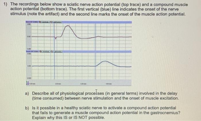1) The recordings below show a sciatic nerve action potential (top trace) and a compound muscle action potential (bottom trac
