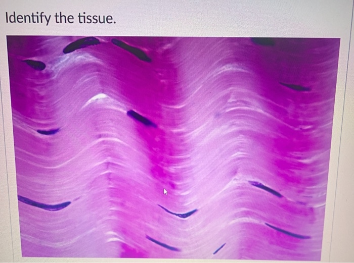 Solved Identify The Tissue. | Chegg.com