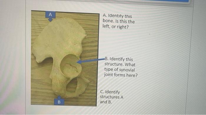 Solved A. Identify this joint What is the structural | Chegg.com