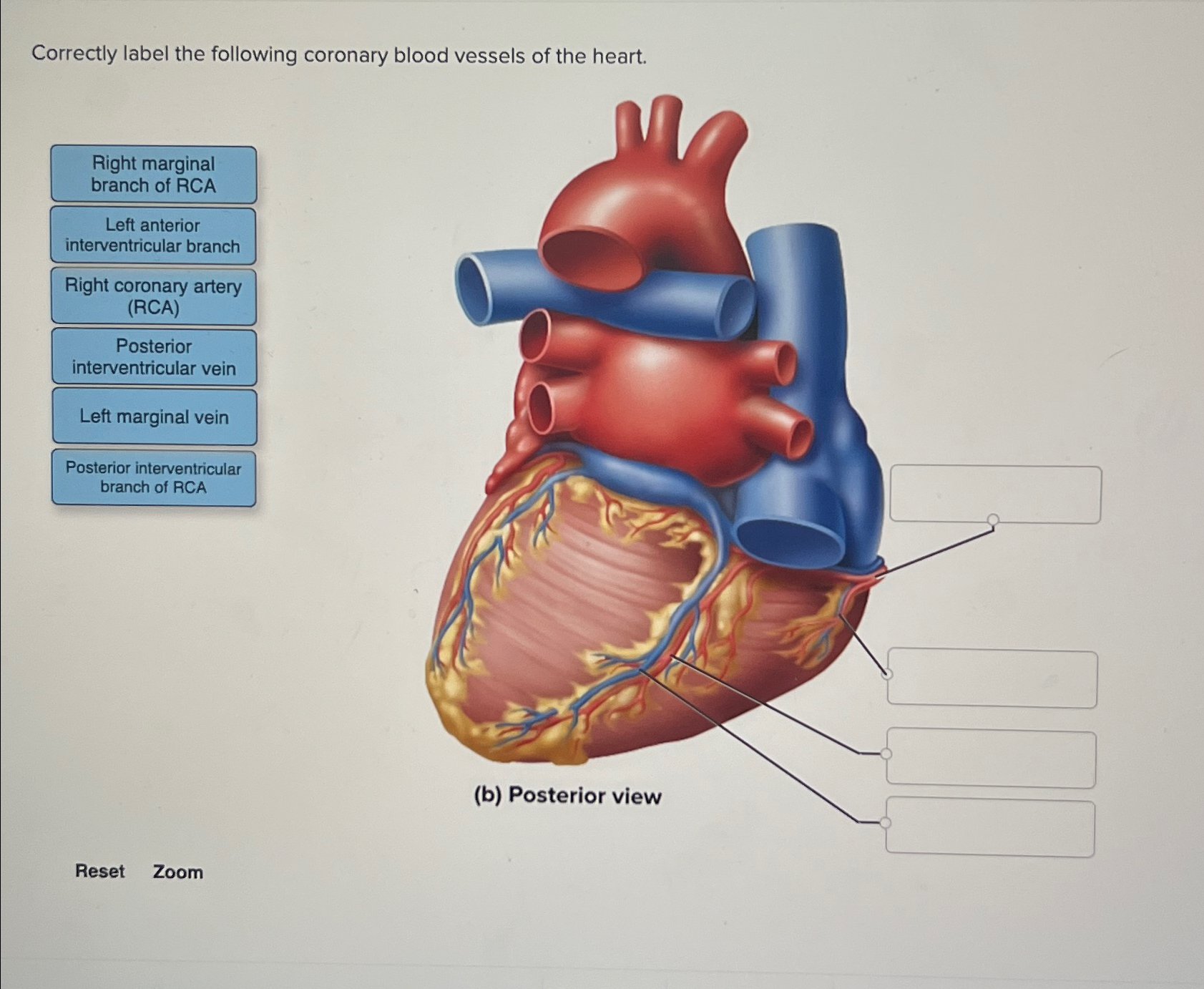 Solved Correctly label the following coronary blood vessels | Chegg.com