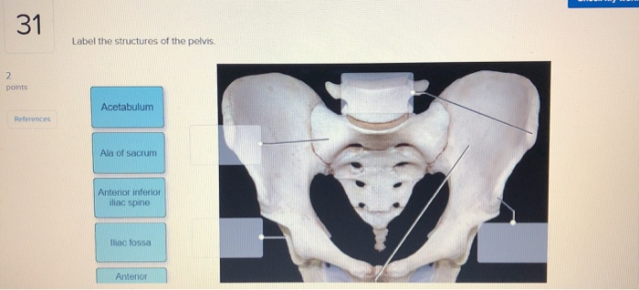 Solved 31 Label The Structures Of The Pelvis. 2 Points | Chegg.com