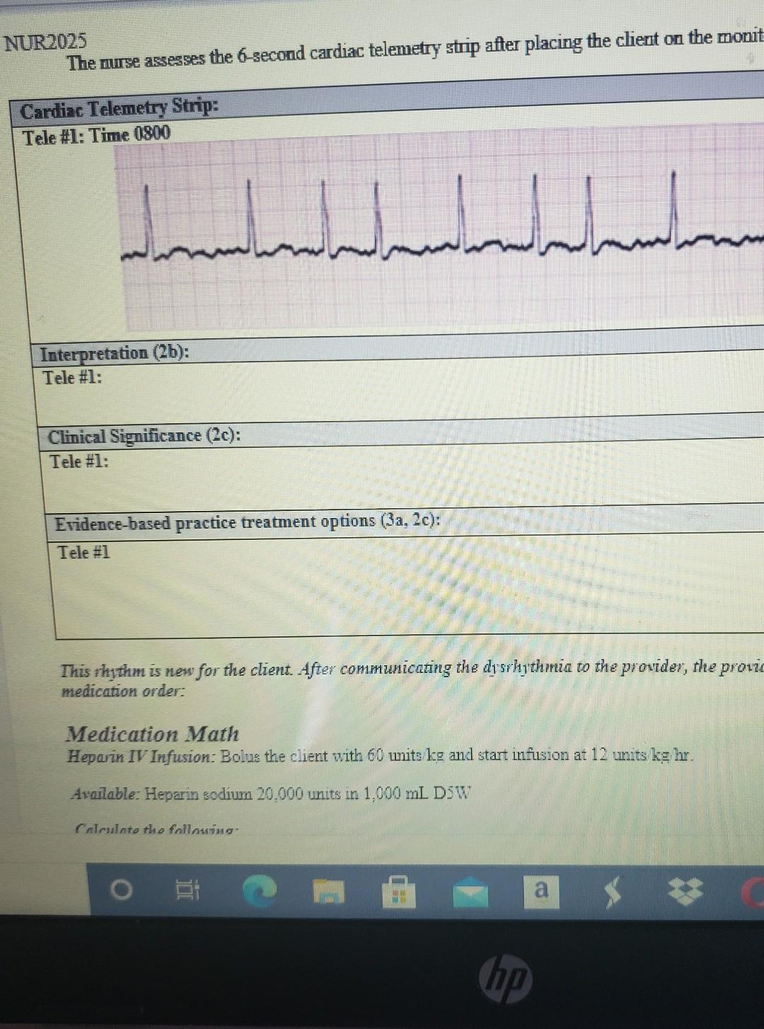 NUR2025 The nurse assesses the 6-second cardiac telemetry strip after placing the client on the monit Cardiac Telemetry Strip