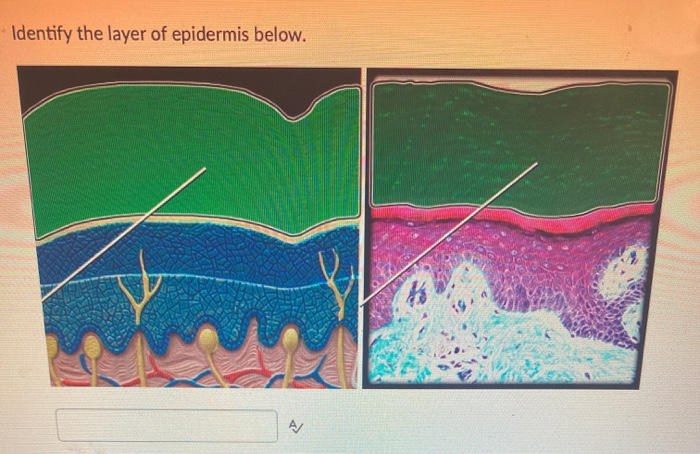 Solved Identify the layer of epidermis below. AJ | Chegg.com