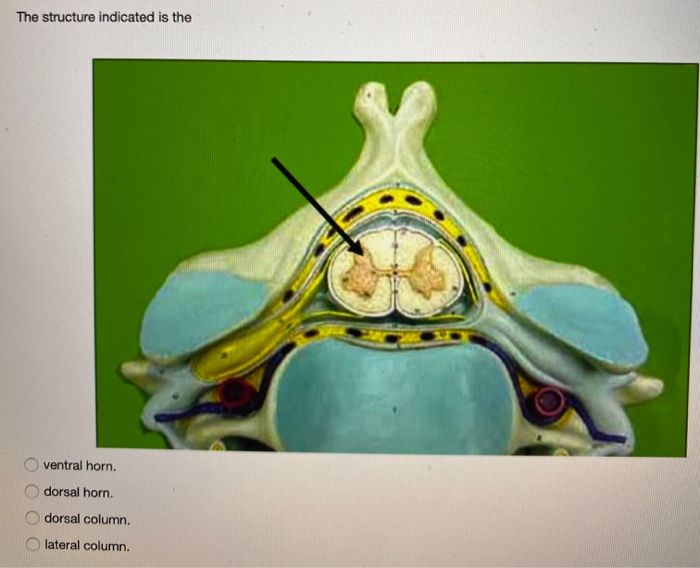 Solved The structure indicated is the ventral horn. dorsal