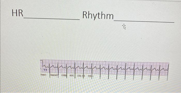 Solved HR RhythmHR RhythmHR Rhythm | Chegg.com