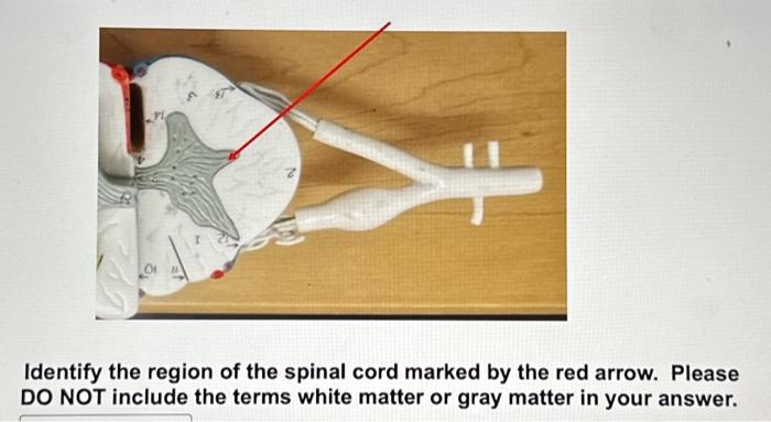 Solved Identify the region of the spinal cord marked by the | Chegg.com