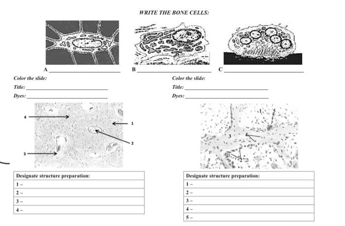 WRITE THE BONE CELLS: Color the slide: Title: Dyes: Color the slide: Title: Dyes: Designate structure preparation: Designate