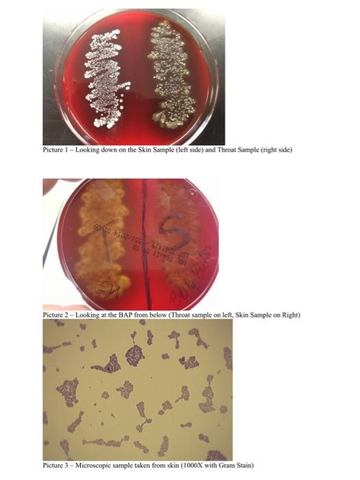Solved Picture I - Looking down on the Skin Sample (left | Chegg.com