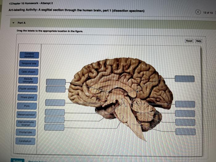 sagittal view of the human brain labeled