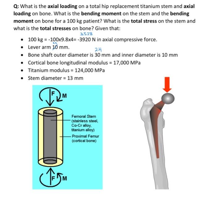 Solved Q What Is The Axial Loading On A Total Hip Chegg Com