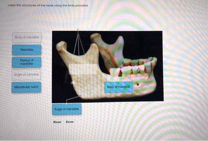 Label the structures of the bone using the hints provided. Body of mandible Mandible Ramus of mandible Angle of mandible Mand