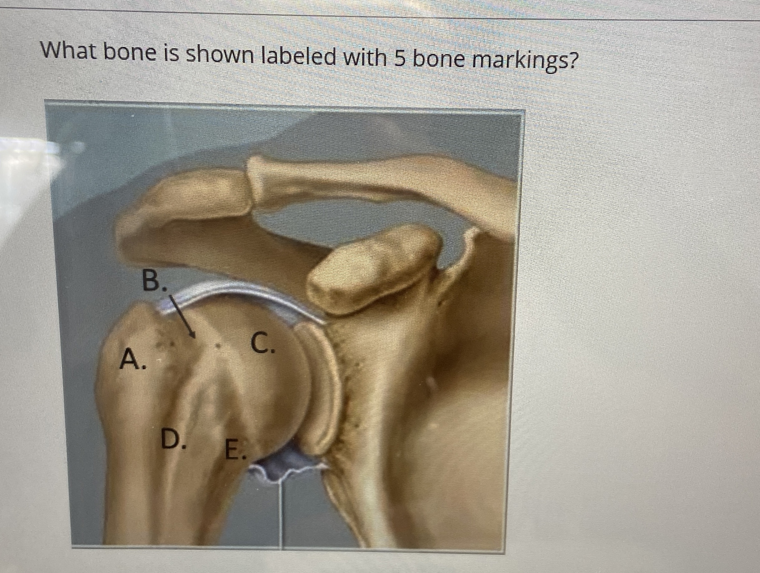 Solved What bone is shown labeled with 5 ﻿bone | Chegg.com