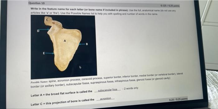 Solved Write in the feature name for each letter (or bone | Chegg.com