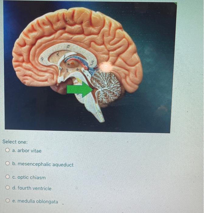 Solved Select One: O A. Corpora Quadrigemina O B. Medulla | Chegg.com