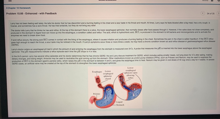 C6 - (Obl) Audiology Science to Practice cap 8-1-12 - 151 After reading  this chapter, you should be - Studocu