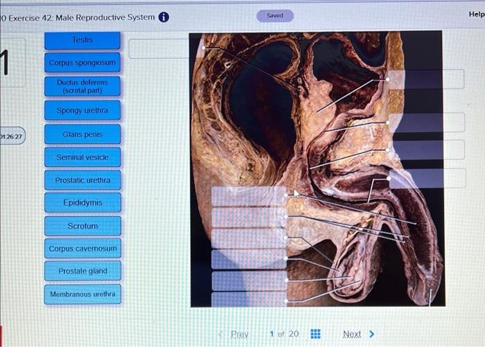 Solved Label the major structure of the male reproductive | Chegg.com