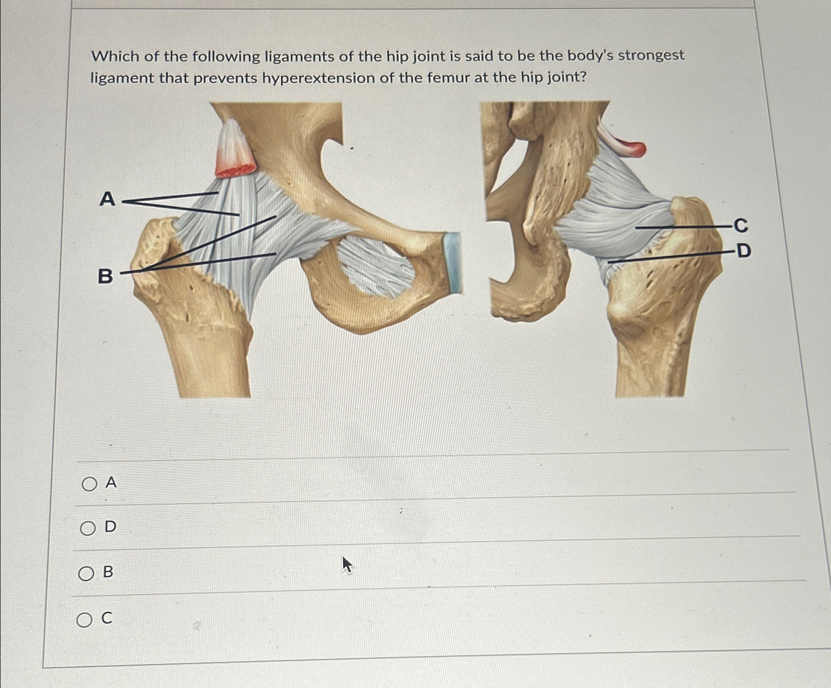 Solved Which of the following ligaments of the hip joint is | Chegg.com