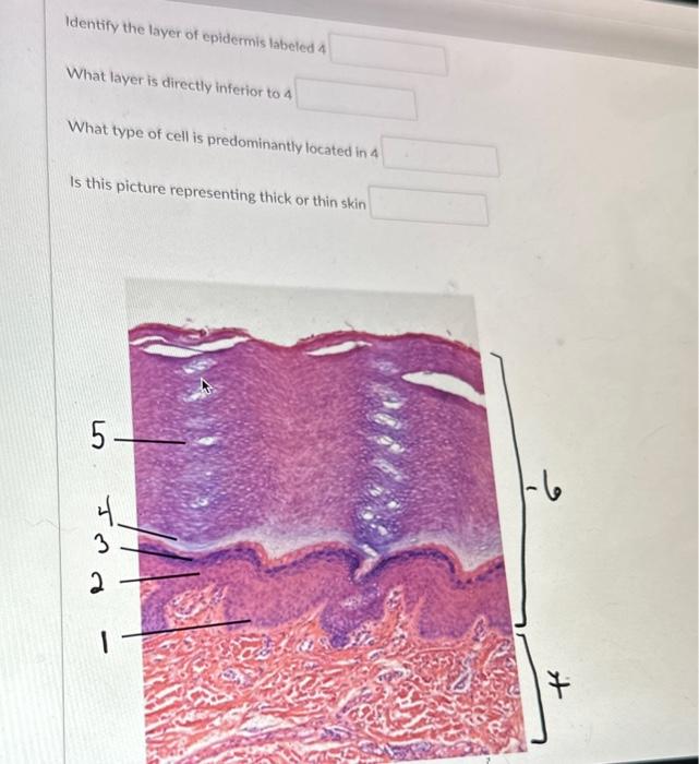 Solved Identify the layer of epidermis labeled 4 What layer | Chegg.com