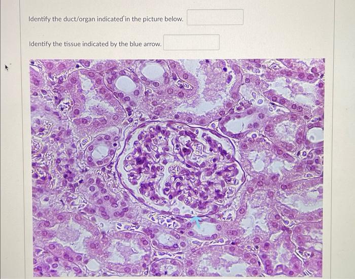 Solved Identify The Duct Organ Indicated In The Picture 