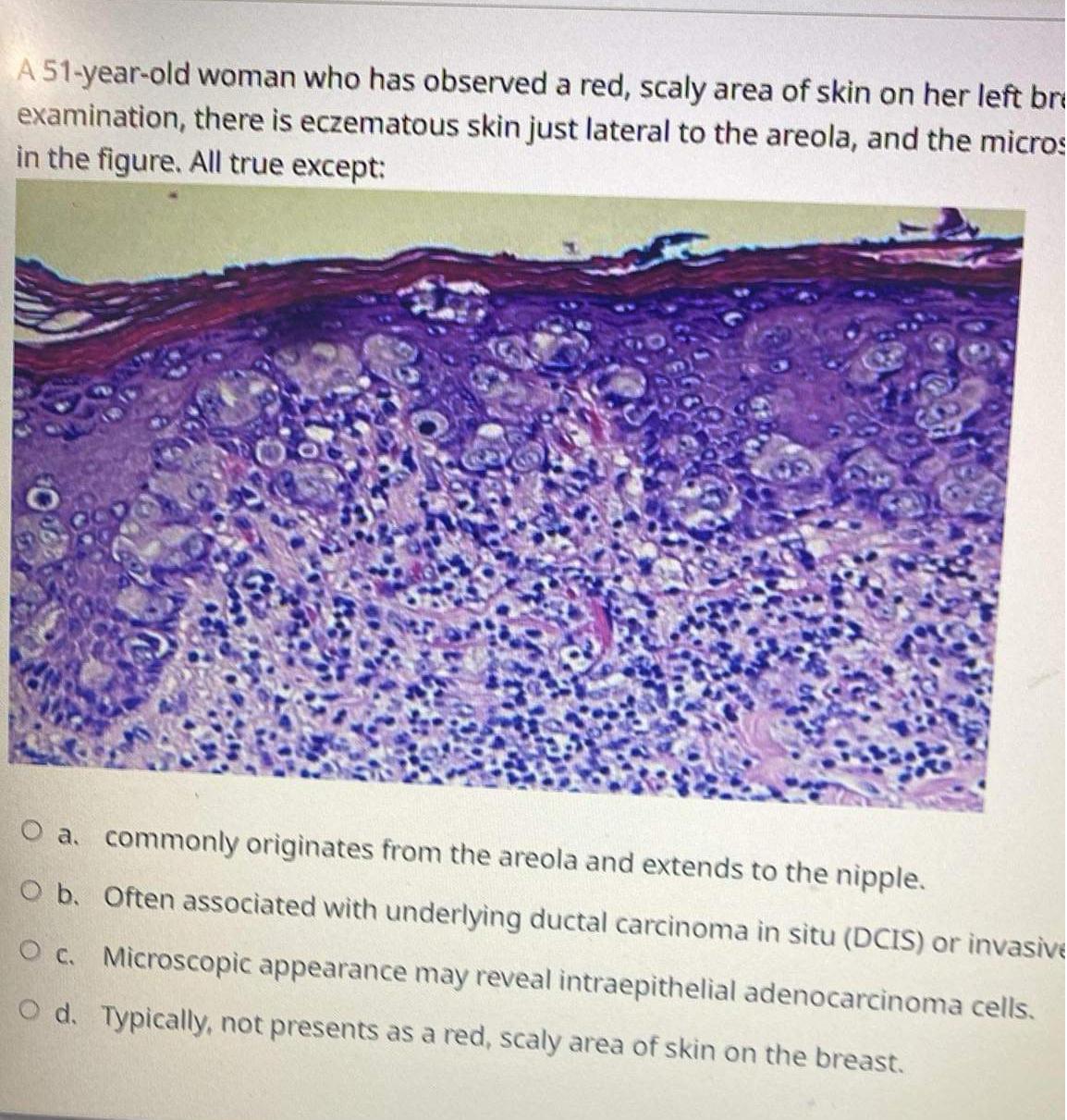 Solved A 51-year-old woman who has observed a red, scaly | Chegg.com