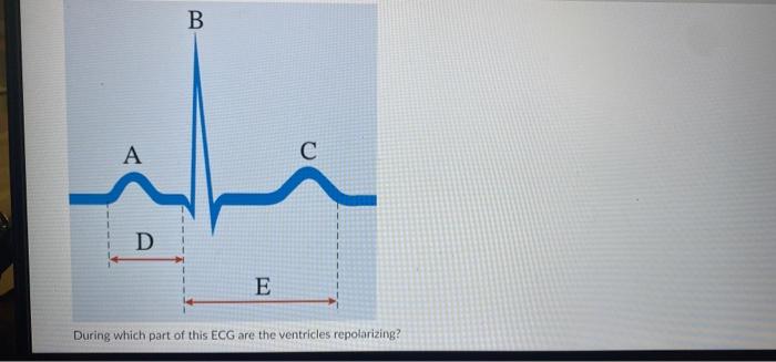 During which part of this ECG are the ventricles | Chegg.com