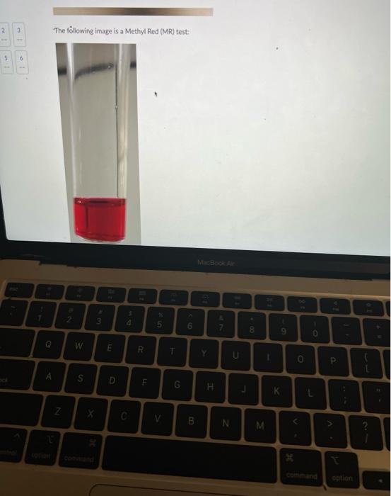 The föliowing image is a Methyl Red (MR) test: