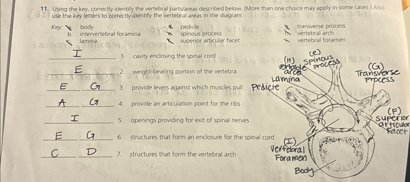 Solved Using the key, correctly identify the vertebral | Chegg.com