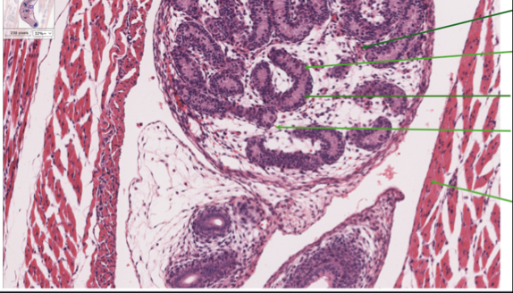 Solved he transverse section of a mouse embryo's testis | Chegg.com