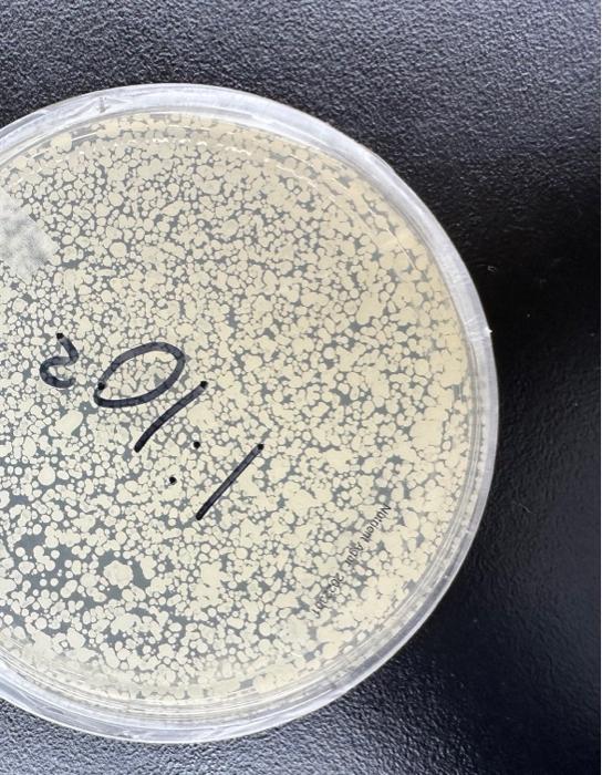 Solved 102 EXERCISE 11 ISOLATION OF BACTERIA BY DILUTION