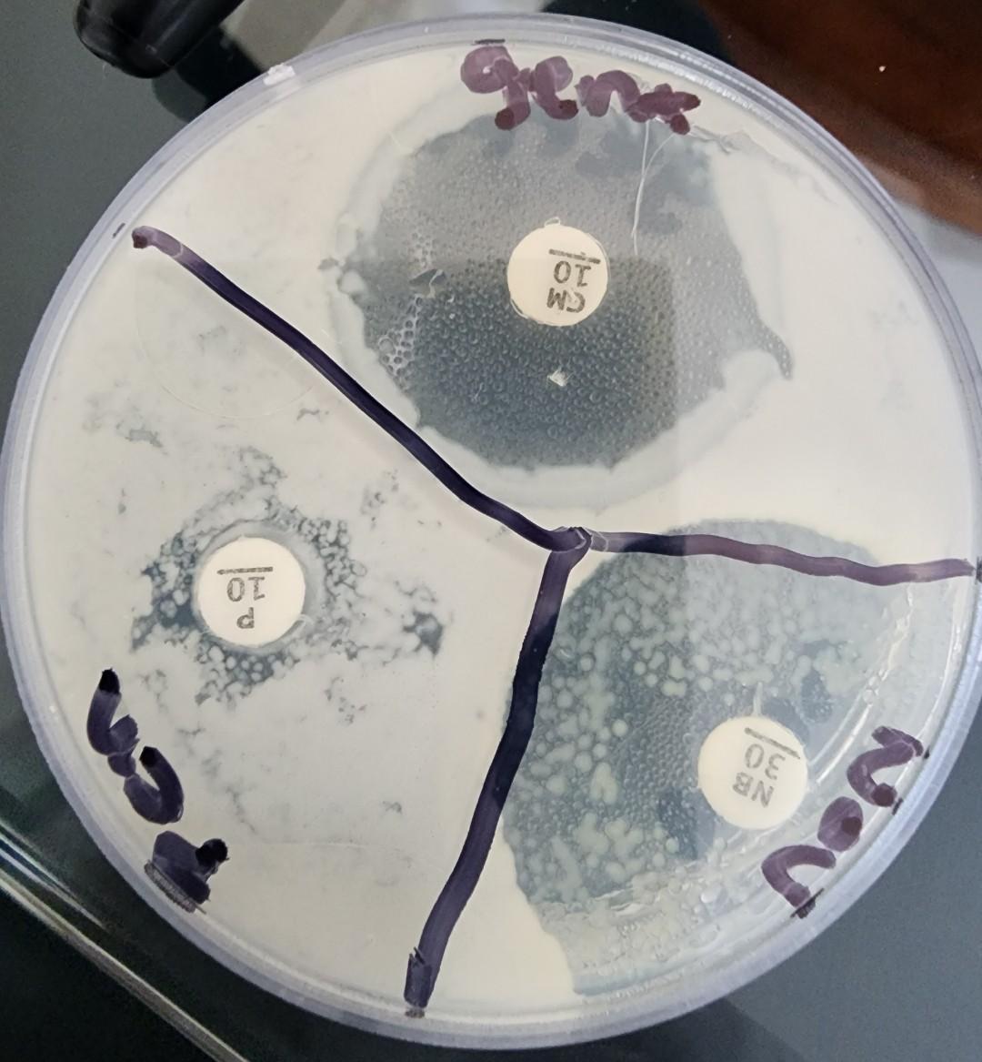 Solved Staphylococcus Epidermidis Is A Common Skin Microbe