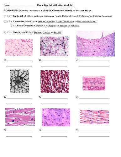 Solved Name Tissue Type Idemtification Werksheet A) Identify | Chegg.com