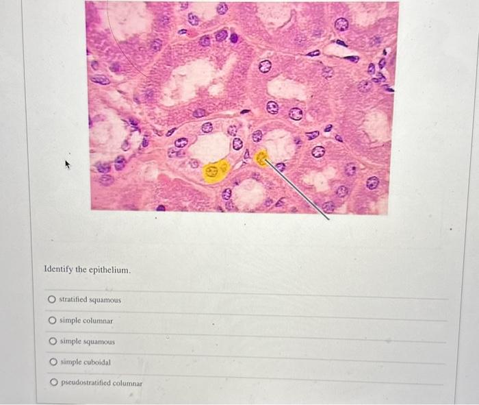 Solved Identify the epithelium. stratified squamous simple | Chegg.com