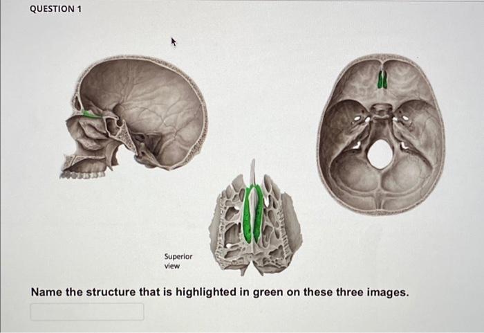 QUESTION 1 Name the structure that is highlighted in | Chegg.com