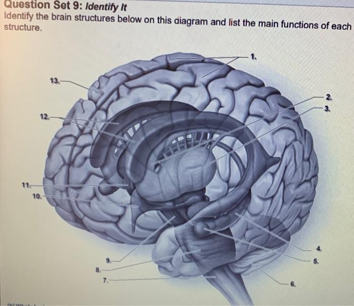 Question Set 9: Identify it Identify the brain | Chegg.com