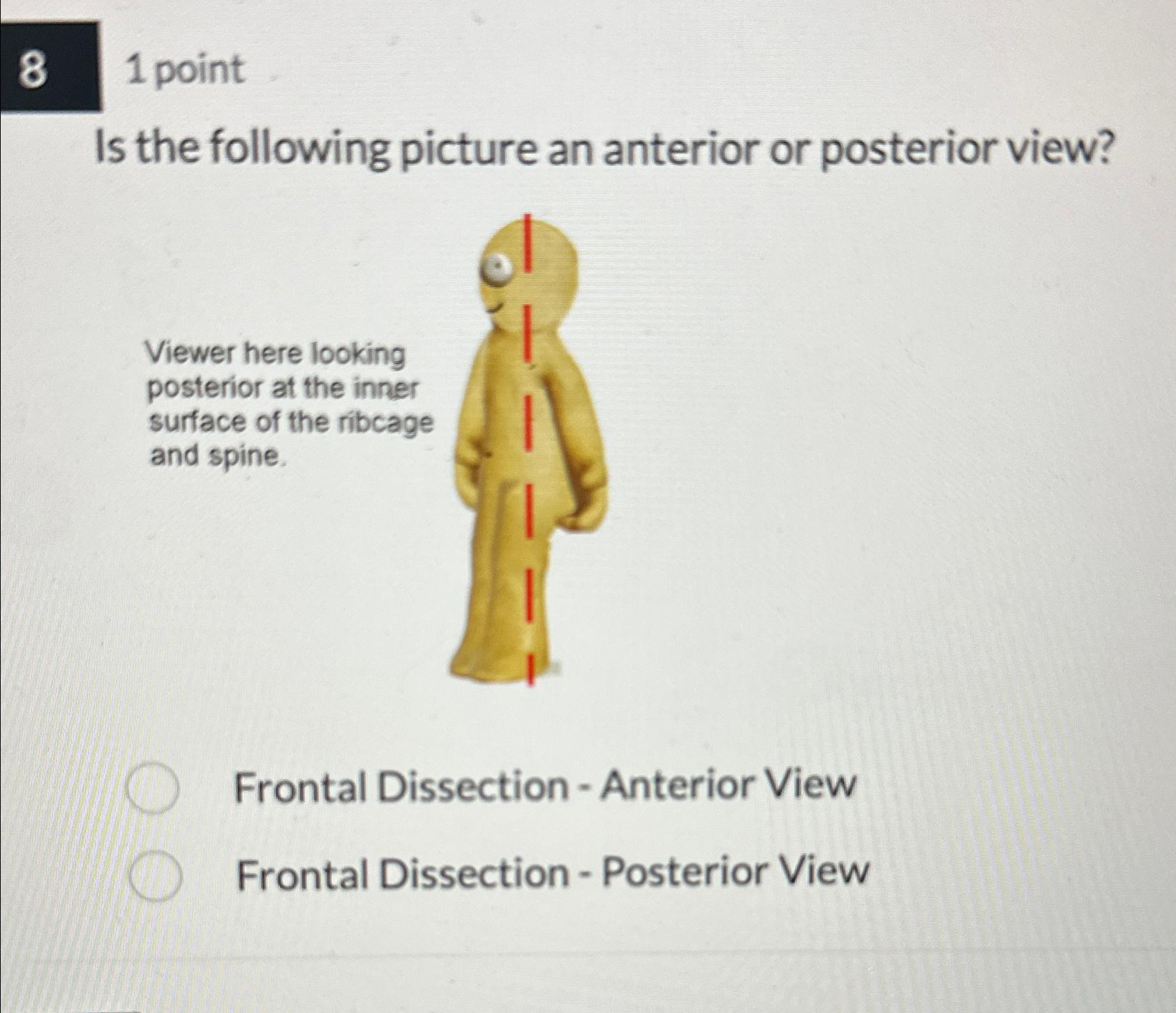 Solved 81 ﻿pointIs the following picture an anterior or | Chegg.com
