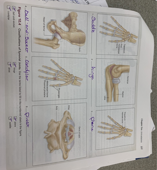 Solved observe this joint on an articulated skeleton. The | Chegg.com