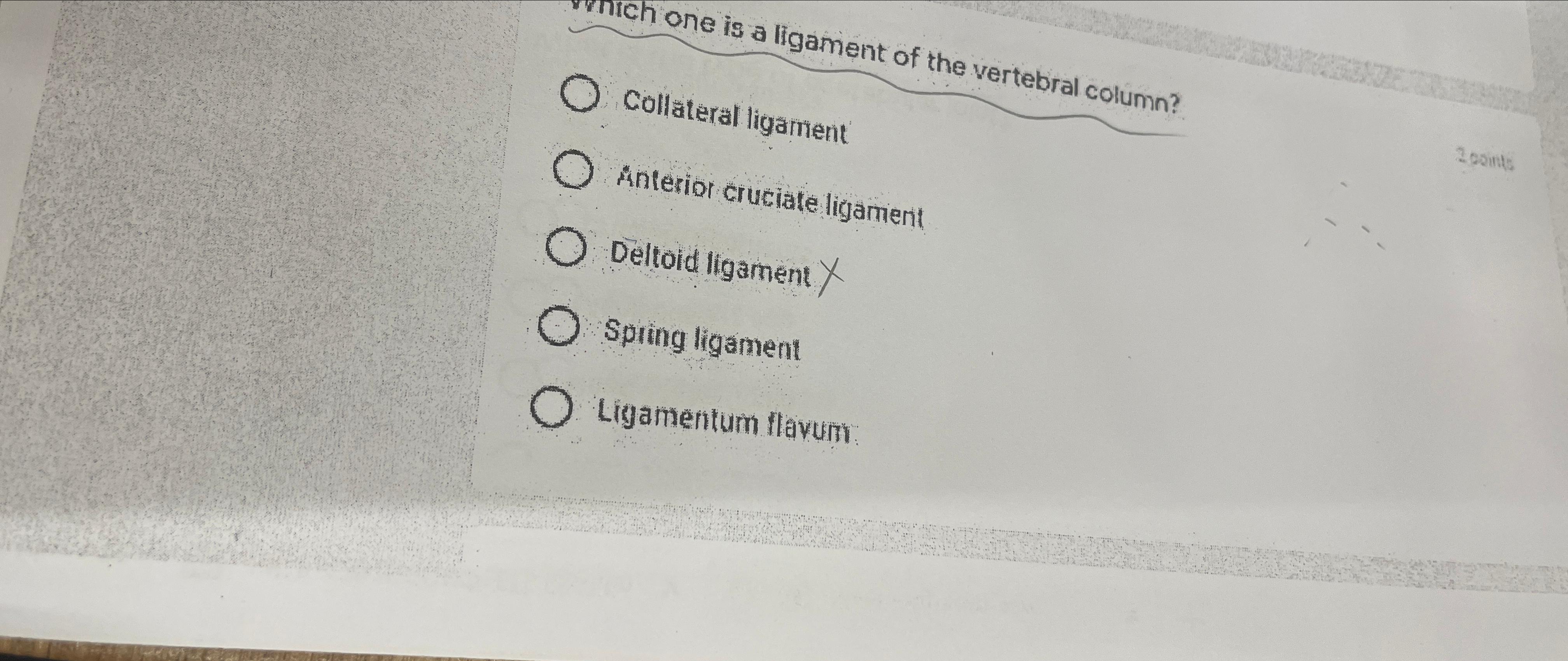 Solved Collateral LigamentAnterior Cruciate LigamentDeltold | Chegg.com